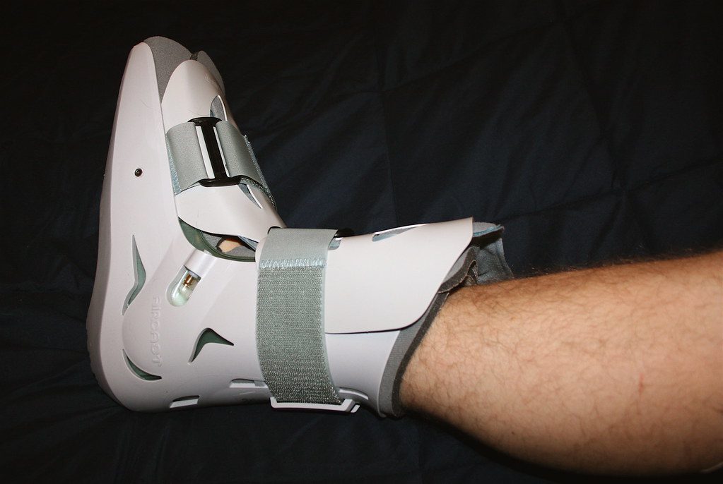 how to prevent stress fracture